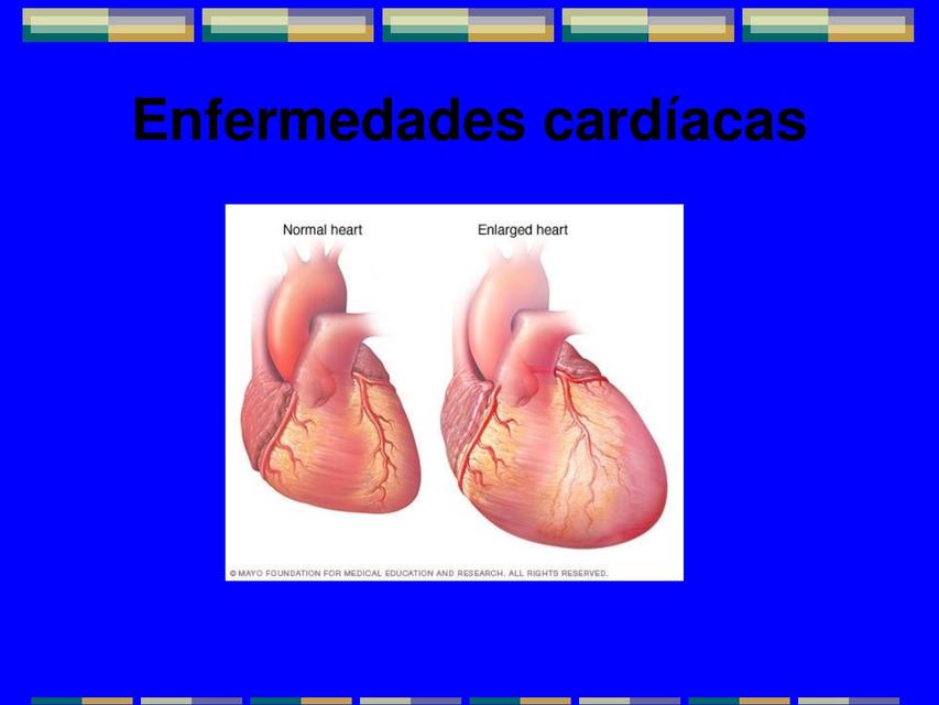 Enfermedades Cardiacas 