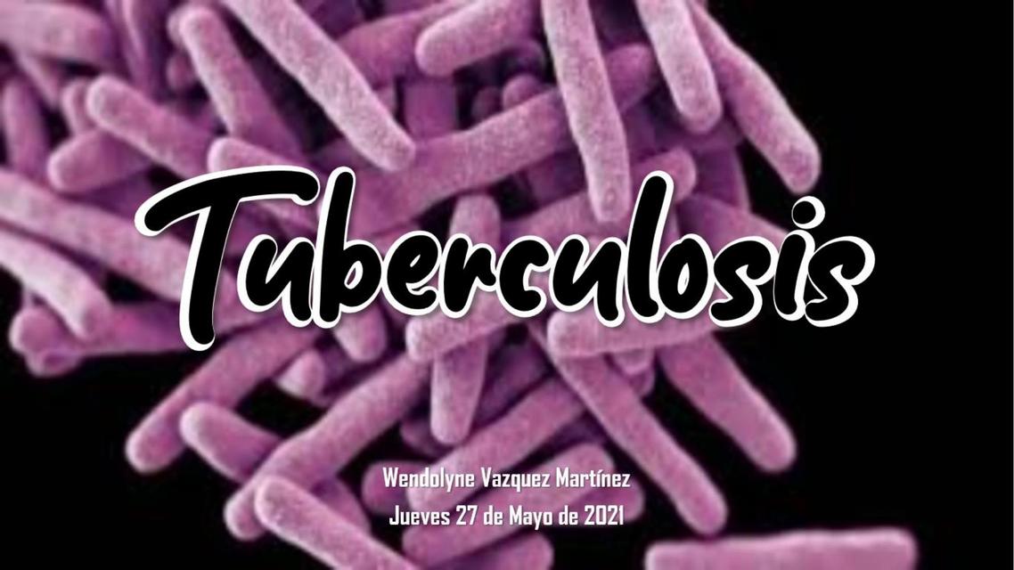 Tuberculosis