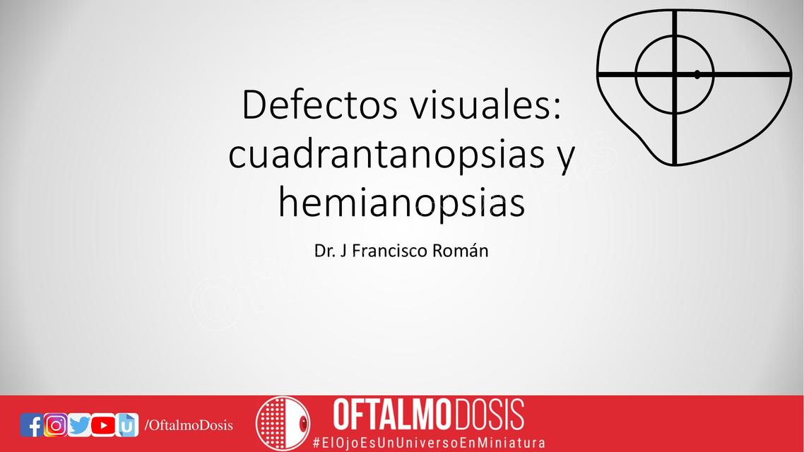 Defectos Visuales: Cuadrantanopsias y Hemianopsias