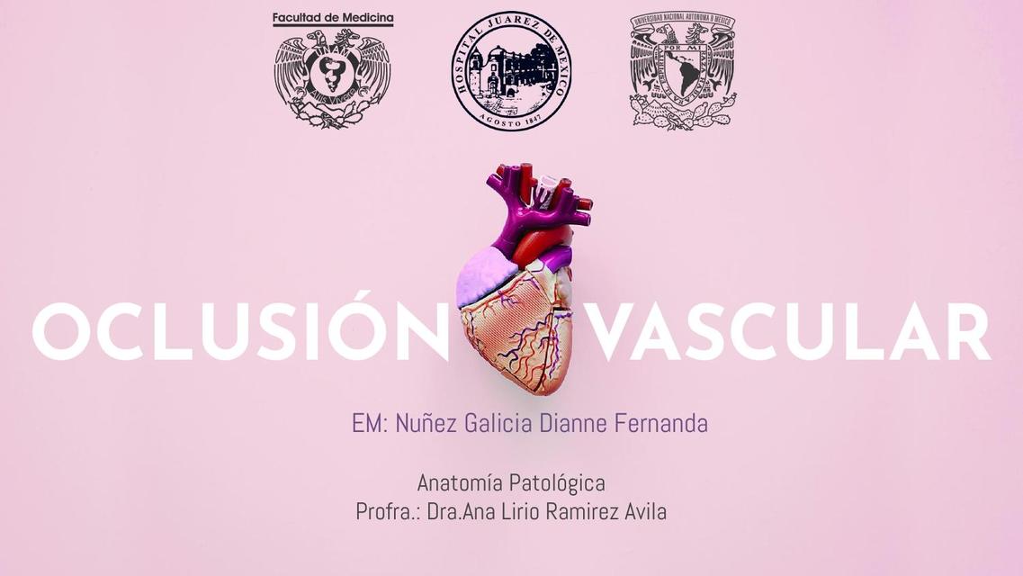 Oclusión Vascular