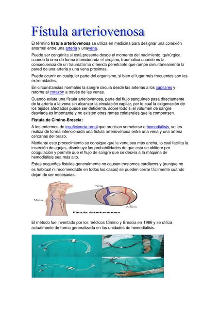 Fístulas arteriovenosas