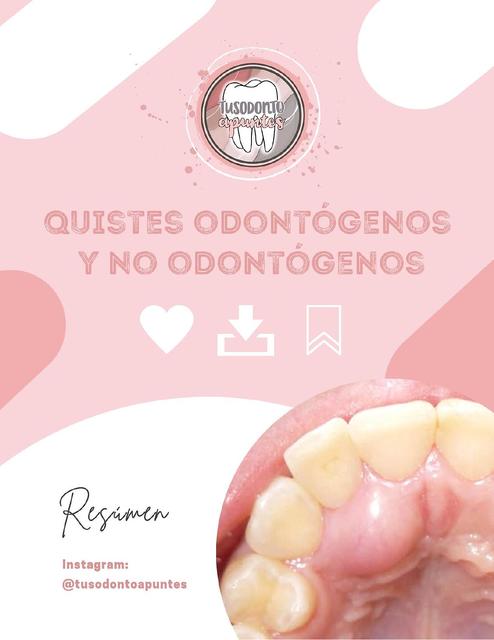 Quistes Odontogénicos y No Odontogénicos