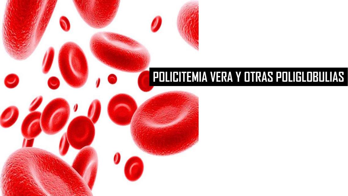 Policitemia vera