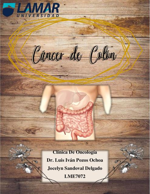 Cáncer de Colon