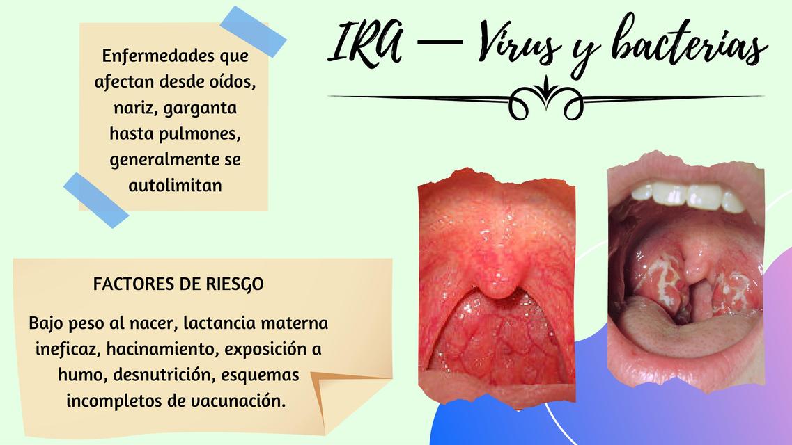 IRA-Virus y Bacterias