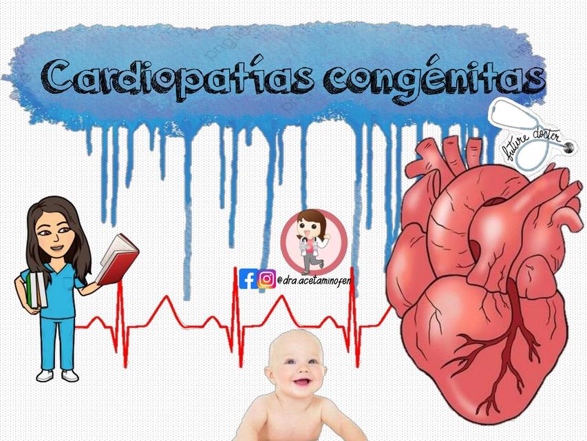 Cardiopatías Congénitas