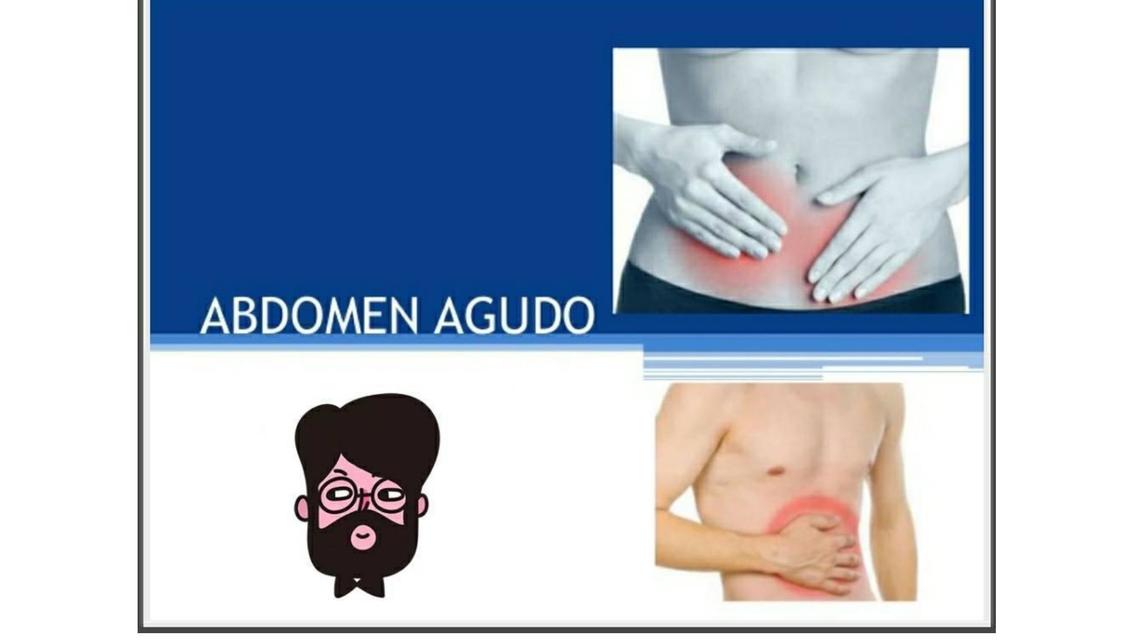 Abdomen Agudo