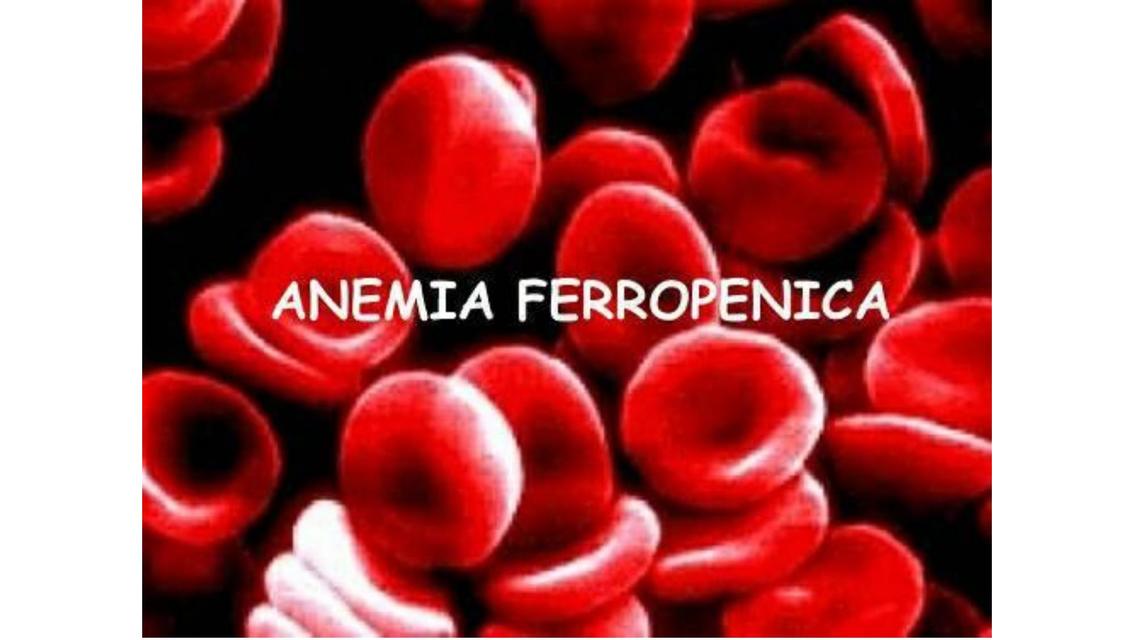 Anemia Ferropenica