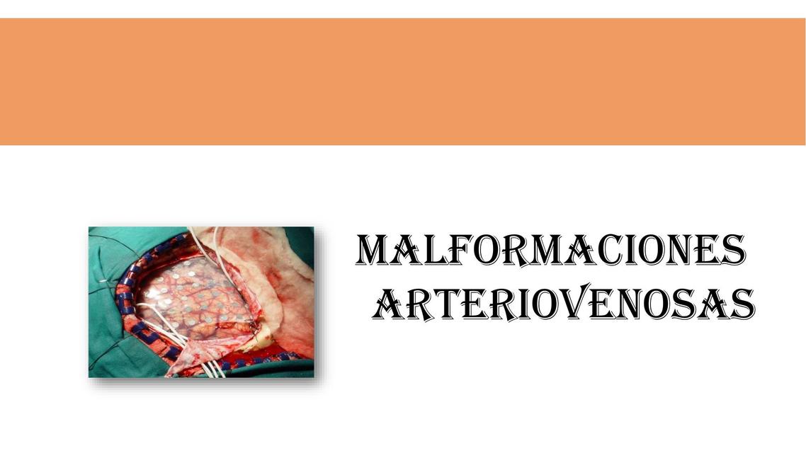 Malformaciones arteriovenosas