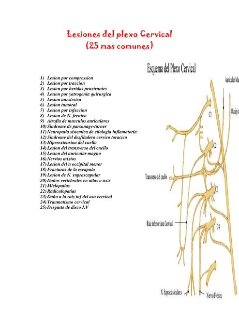 Lesiones del plexo Cervical