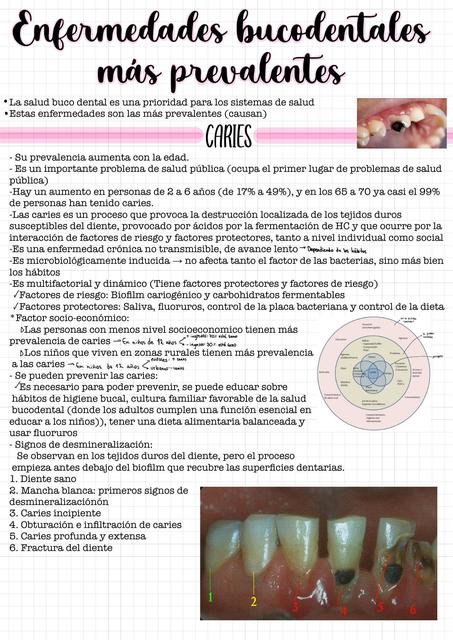 Enfermedades Bucodentales más Prevalentes