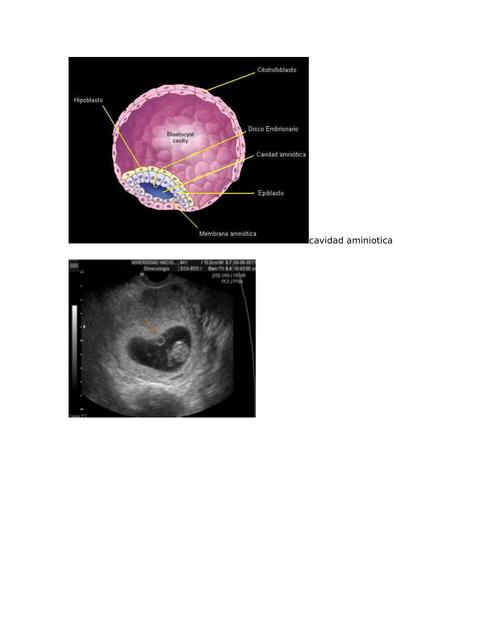 Cavidad Amniótica