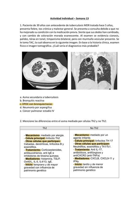 Caso Clínico Tuberculosis 