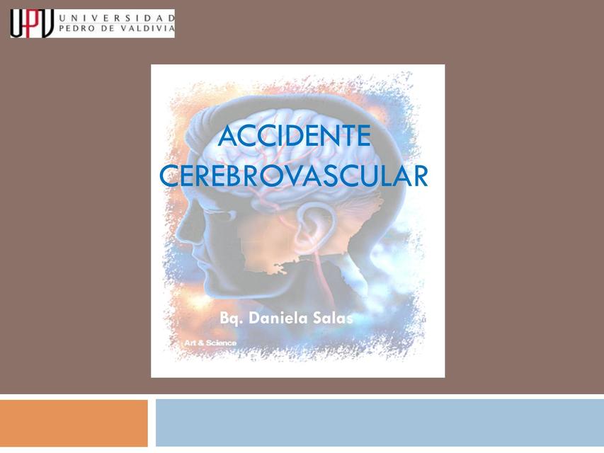 Accidente cerebrovascular