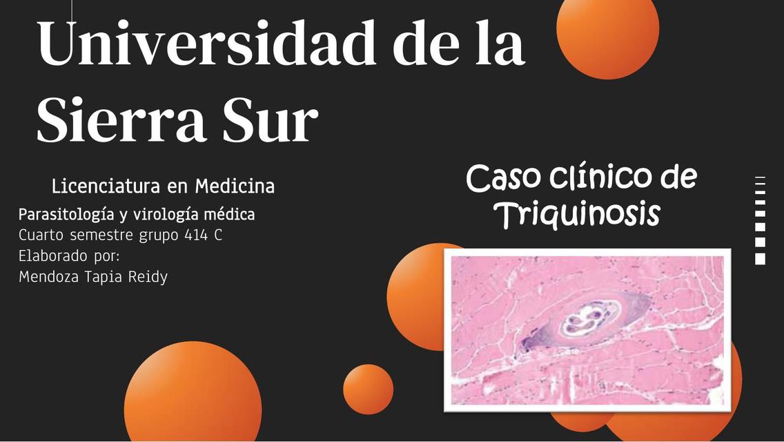 Caso clínico Triquinosis 