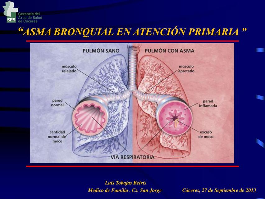 Asma Bronquial en Atención Primaria