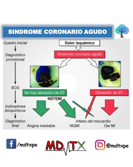 Síndrome coronario agudo