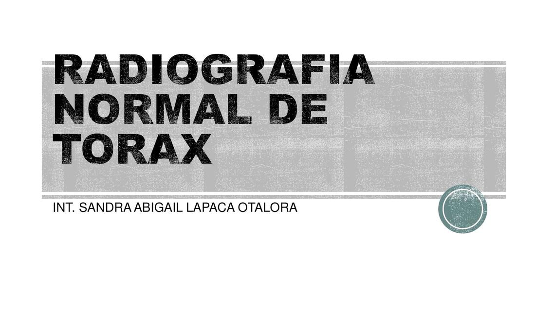 Radiografía Normal de Tórax 