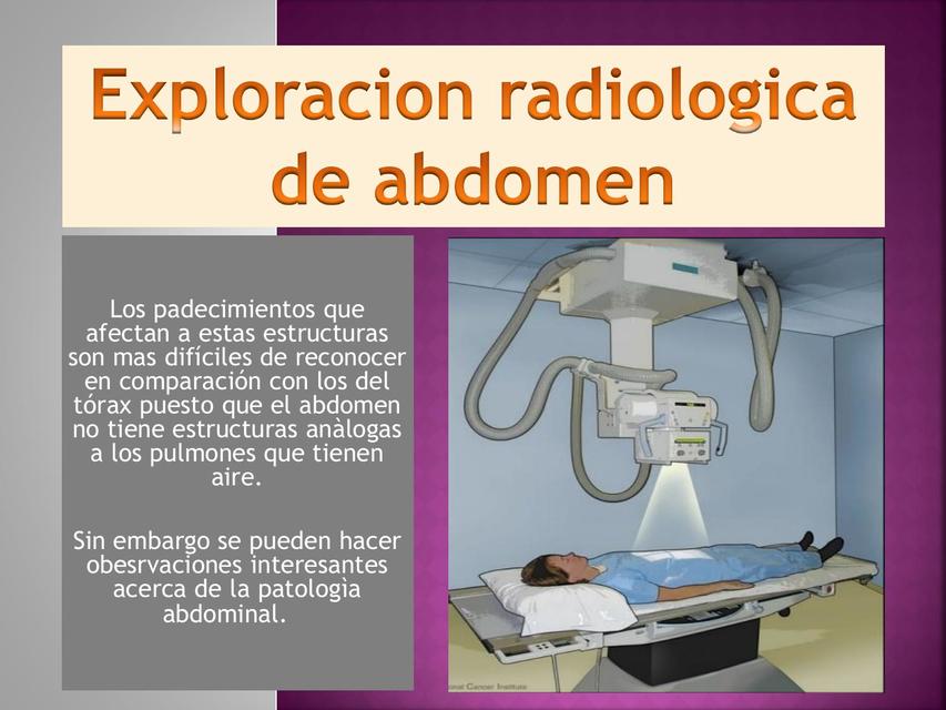 Radiografía simple de abdomen