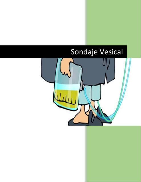 Sondaje Vesical