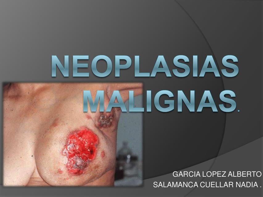 Neoplasias Malignas