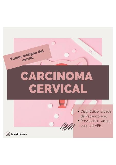 Carcinoma Cervical