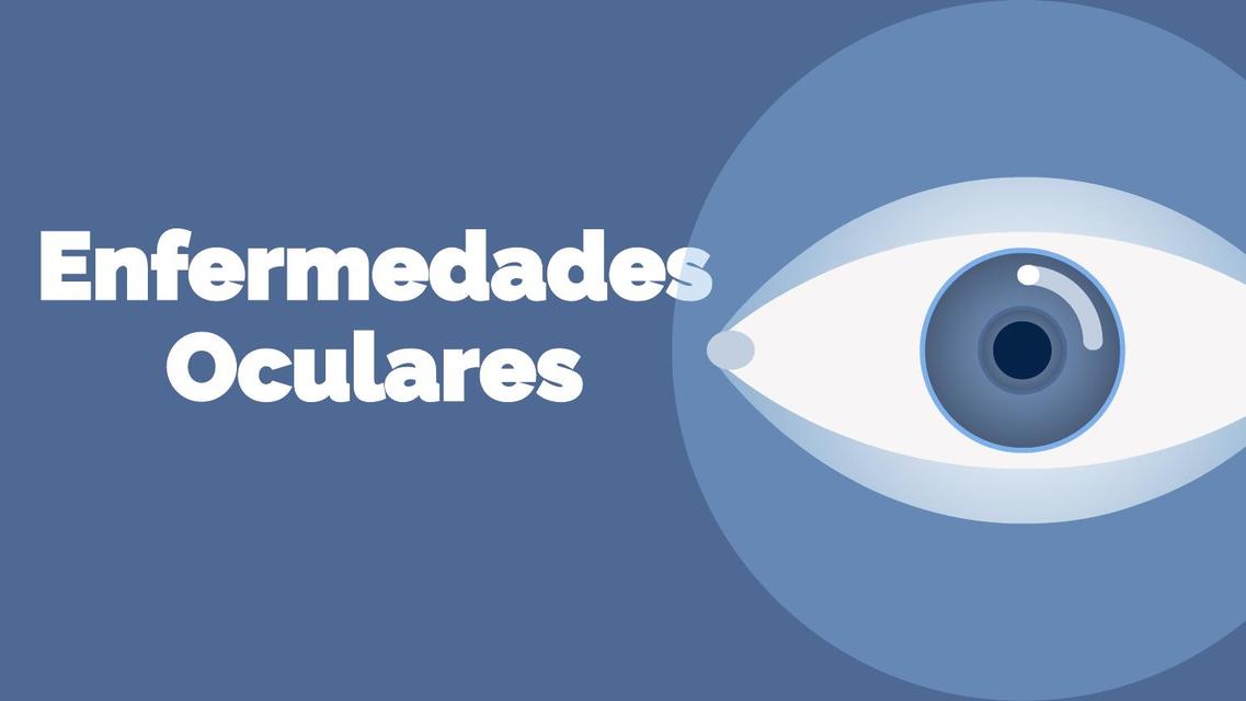 Enfermedades Oculares