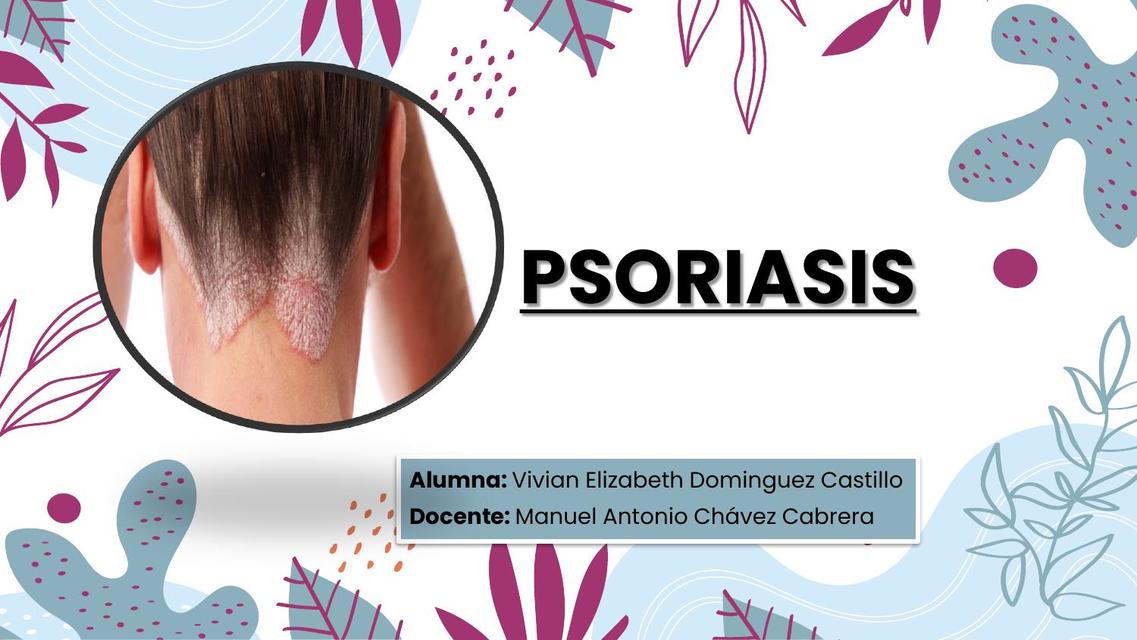 Psoriasis 