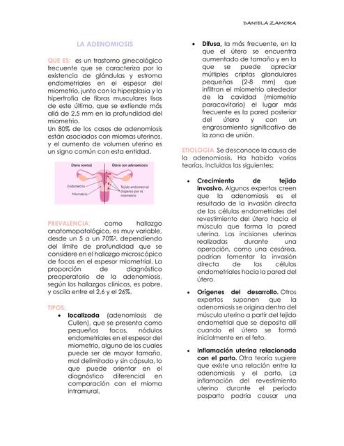 Adenomiosis