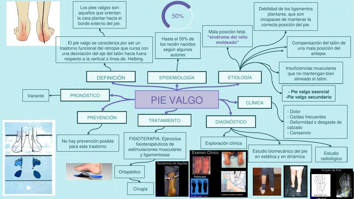 Pie Valgo