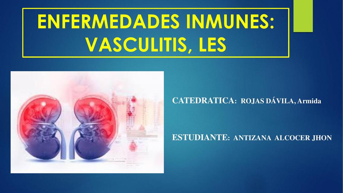 Enfermedades Inmunes: Vasculitis, Les