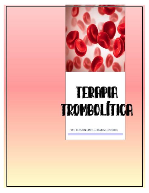 Terapia Trombolítica