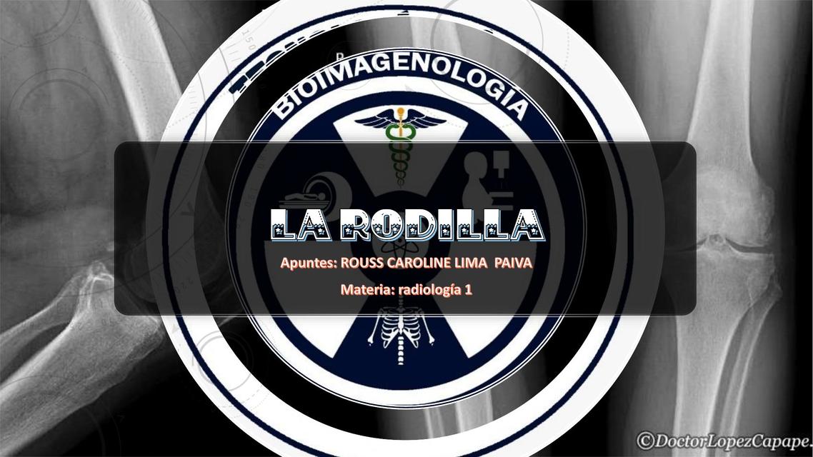 Radiología de la Rodilla