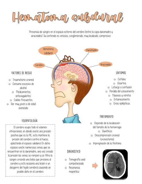 Hematoma subdural 