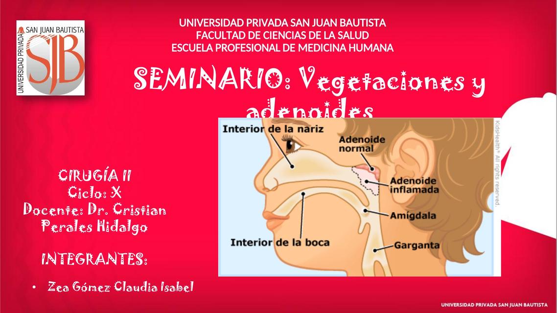 Vegetaciones y Adenoides | claudia zea gomez | uDocz