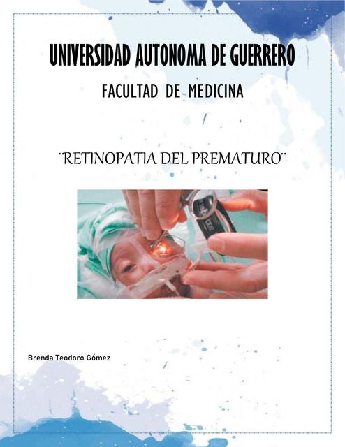 Retinopatía del Prematuro