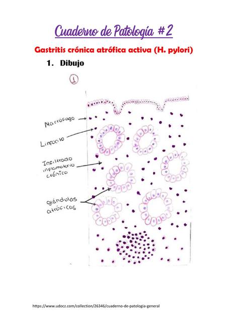 GASTRITIS CRONICA ATROFICA HISTOLOGIA