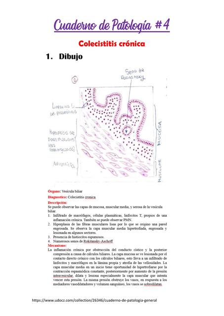 COLECISTITIS CRÓNICA HISTOLOGIA LINFADENITIS GRANULOMATOSA