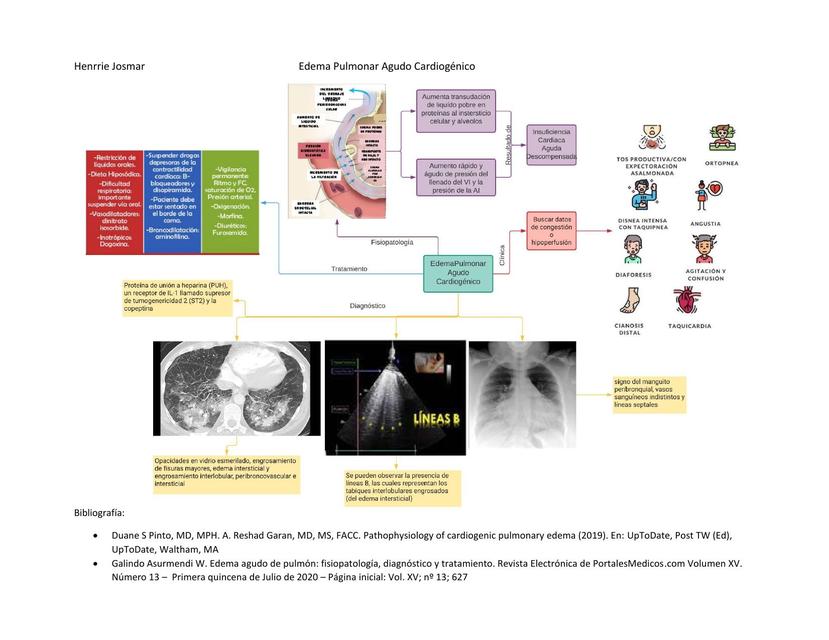 Edema Pulmonar Agudo Cardiogénico