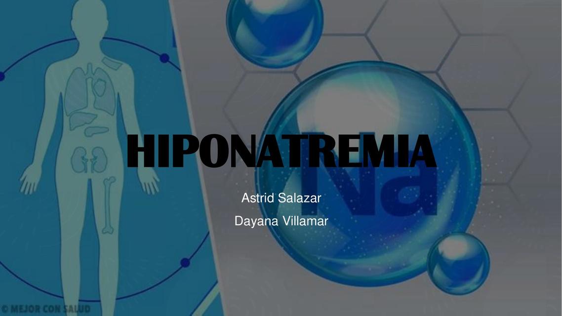 Hiponatremia