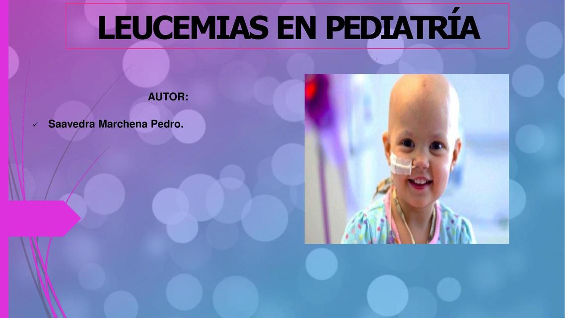 Leucemia en Pediatría 