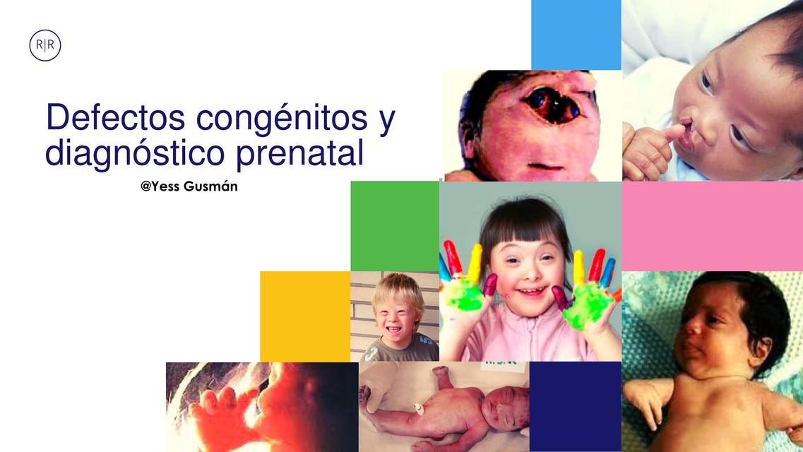 Defectos Congénitos y Diagnostico Prenatal 