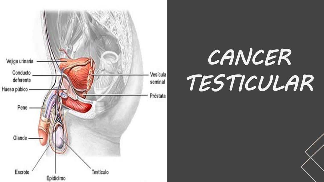 Cáncer Testicular