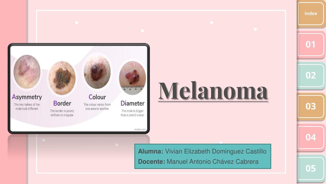 Melanoma 