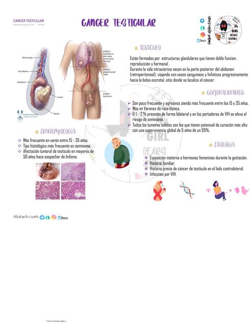 Cáncer Testicular