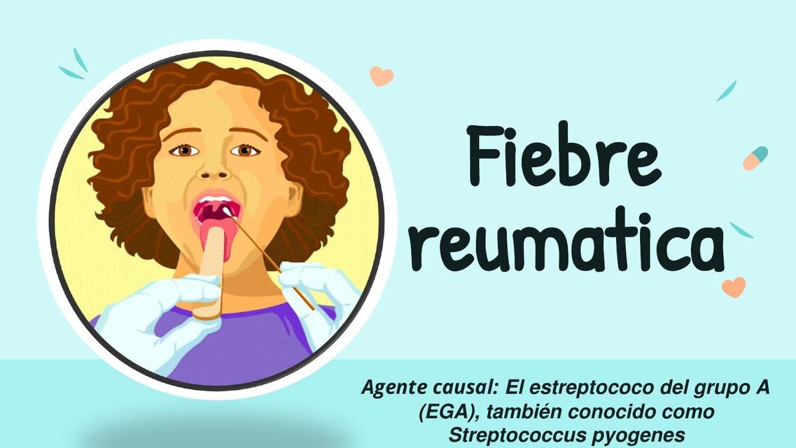 Fiebre Reumática 