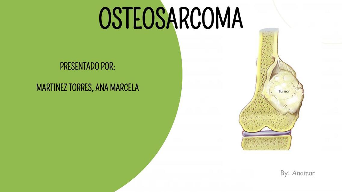 Osteosarcoma