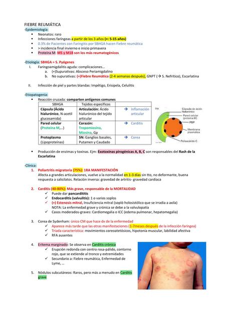 Fiebre Reumática