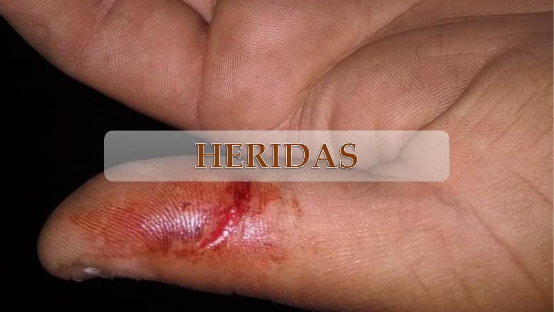 Heridas