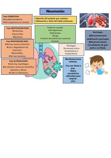 Neumonía